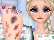 العاب طبية جراحية للكبار Elsa Foot Injured