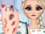 العاب طبية جراحية للكبار Elsa Foot Injured